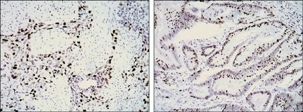 KI67 Antibody