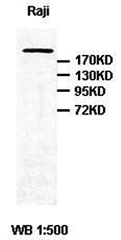Ki67 Rabbit Polyclonal Antibody