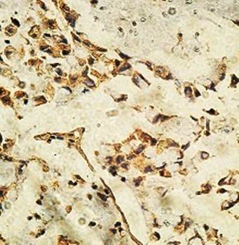 KIAA0174 Rabbit Polyclonal Antibody