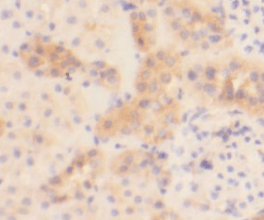KIAA0182 antibody