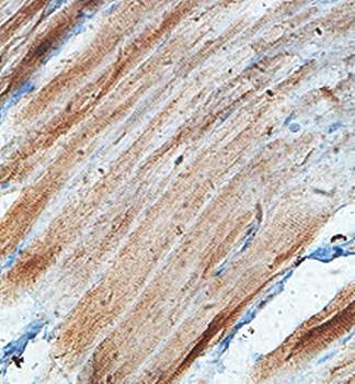 KIAA0284 Rabbit Polyclonal Antibody