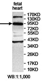 KIAA0317 antibody