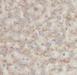 KIAA0368 antibody
