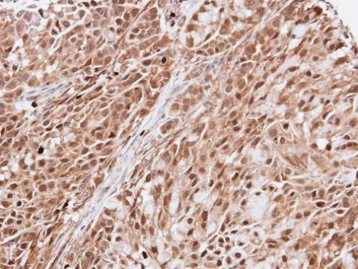 KIAA0494 antibody [N3C3]