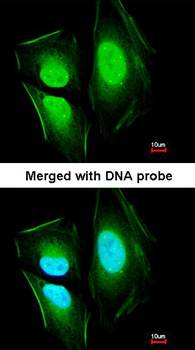 KIAA0494 antibody