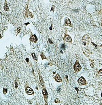 KIAA0494 Rabbit Polyclonal Antibody