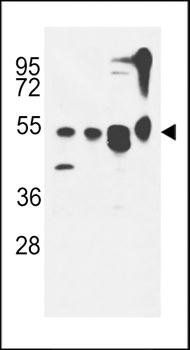 KIAA0652 antibody