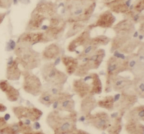 KIAA0774 antibody