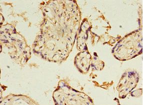 KIAA1191 Antibody