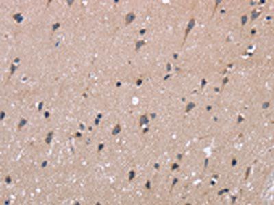 KIAA1324 Antibody