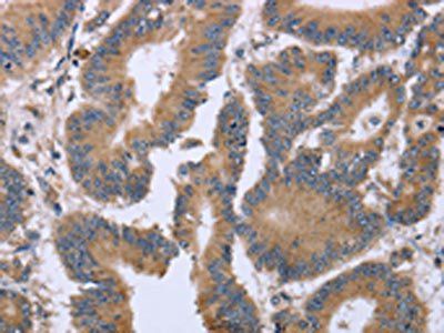 KIAA1324 Antibody