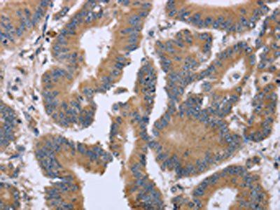 KIAA1324 antibody