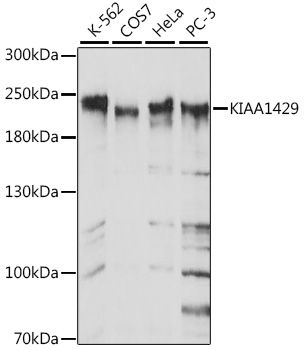 KIAA1429 antibody