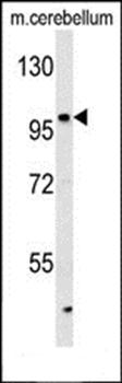 KIAA1688 antibody