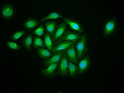 KIF13B Antibody