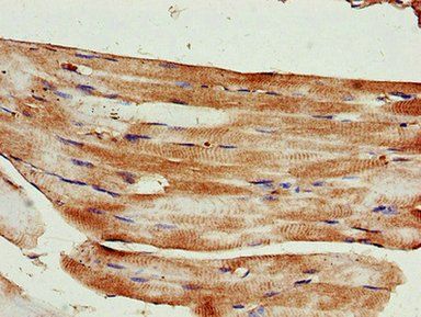 KIF14 antibody