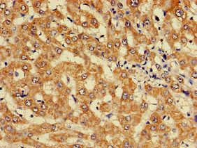 KIF17 Antibody
