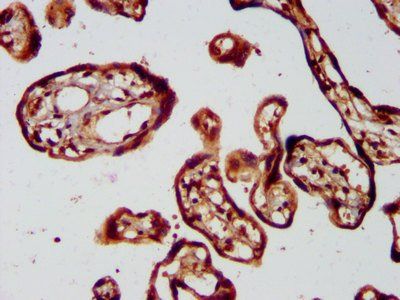 KIF1BP Antibody