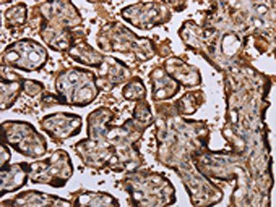 KIF1C Antibody