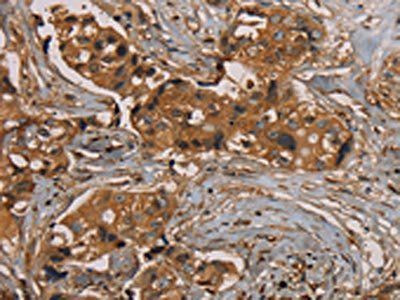 KIF20A Antibody