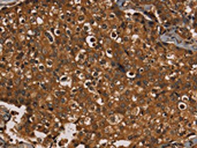 KIF20A Antibody