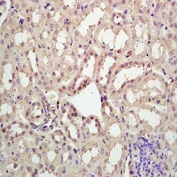 KIF20A Rabbit Polyclonal Antibody