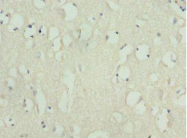 KIF3A Antibody