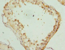 KIF3A Antibody