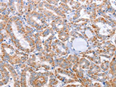 KIF3A Antibody