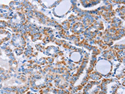 KIF3A Antibody