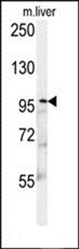 KIF9 antibody