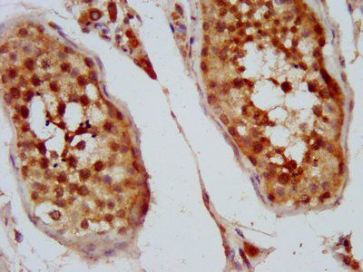 KIFAP3 Antibody