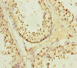 KIFC3 Antibody