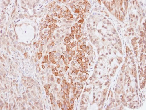HMW Kininogen antibody
