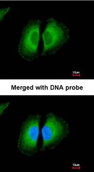Kininogen LC Rabbit Polyclonal Antibody