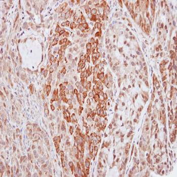 Kininogen LC Rabbit Polyclonal Antibody