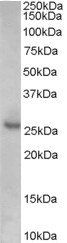 P27KIP1/CDKN1B (internal) Antibody