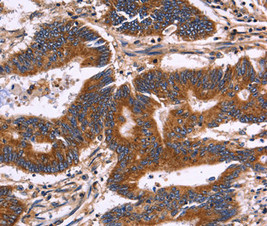 KIR2DL3 antibody