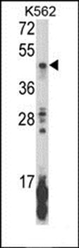 KIR2DL5B antibody