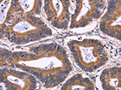 KIR2DL3/KIR2DL1/KIR2DL4/KIR2DS4 Antibody