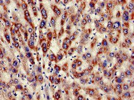 KIR3DL1 Antibody