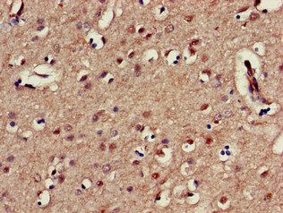 KIR3DL1 Antibody