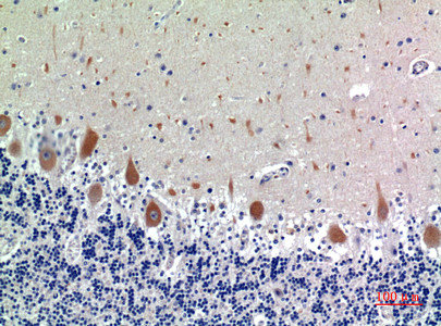 KIR3DL1 antibody