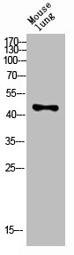 KIR3DL1 antibody
