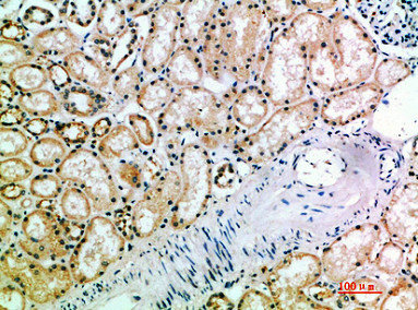 KIR3DL2 antibody