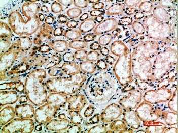 KIR3DL2 Antibody