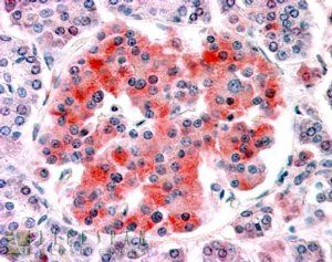 Goat anti-Kcnj11 / Kir6.2 Antibody