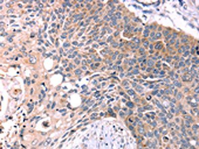 KISS1R Antibody