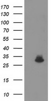 UHMK1 Antibody