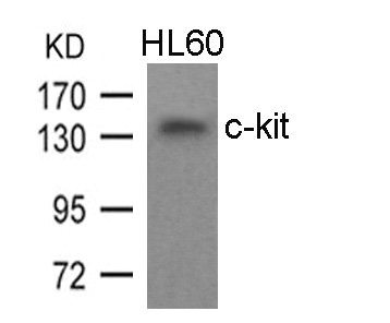 KIT (Ab-936) Antibody